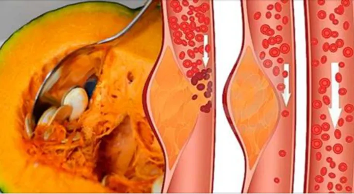 A mis 49 años nunca he sufrido de colesterol y arterias obstruidas, quiero compartir mi secreto contigo