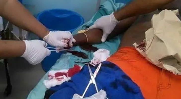 Hombre le corta la mano a su hermano durante riña en Restauración