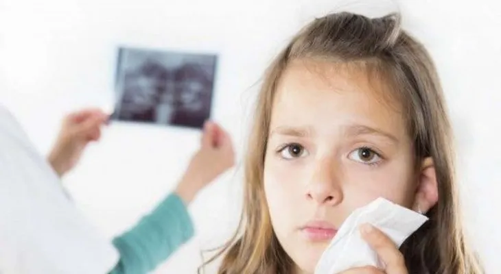 Tips para reducir el dolor después de extaer un diente