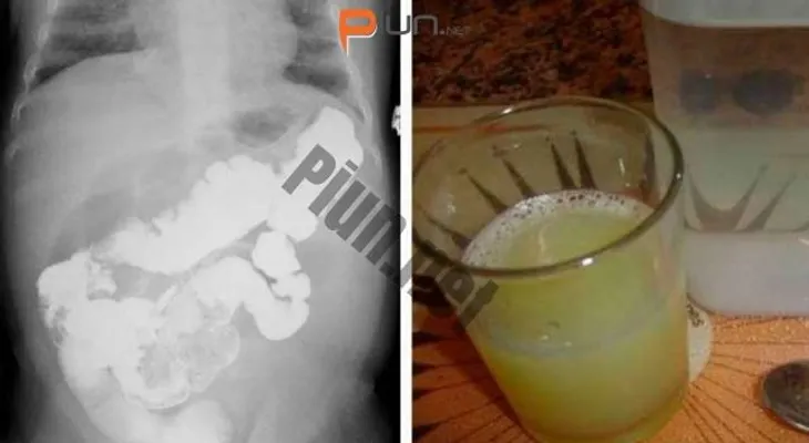 Desintoxica tu cuerpo en solo 3 días para limpiar tu colon, hígado y pulmones y dejarlos como nuevos!