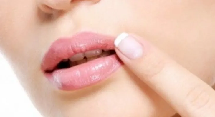 Remedios para evitar el herpes labial