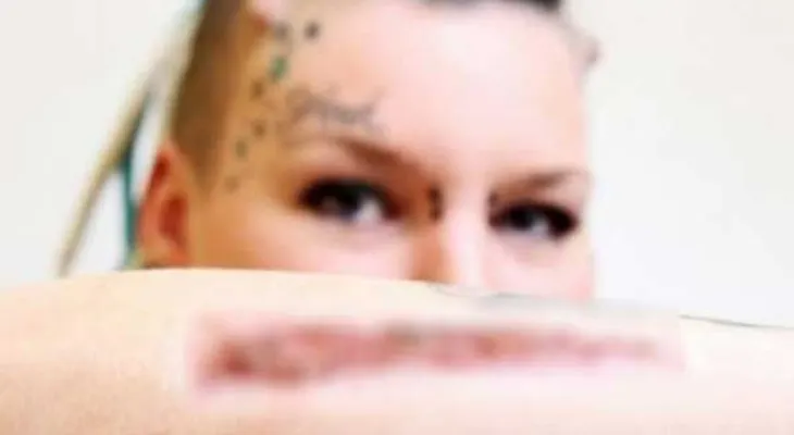 Se cortó la piel tatuada con el nombre de su ex y se la mandó de "regalo sorpresa"