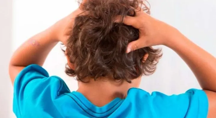 Pediculosis: Cómo combatir la molesta picazón