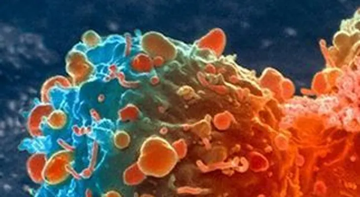 Desarrollan nueva prueba que permite detectar el cáncer en diez minutos