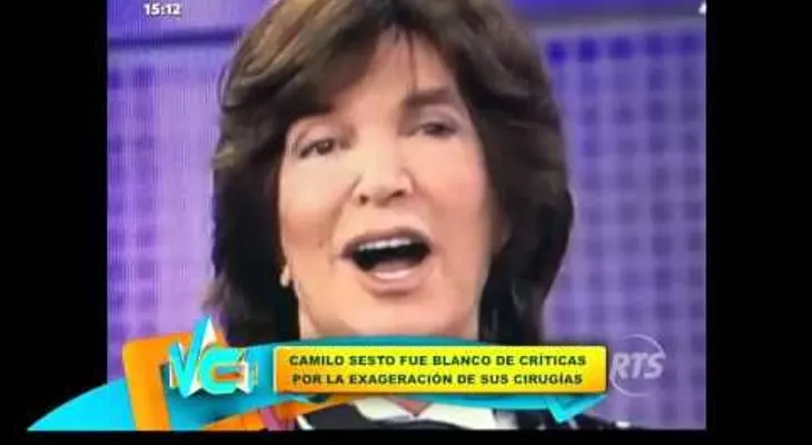 Camilo Sesto y sus asombrosos cambios físicos que han sido objeto de memes