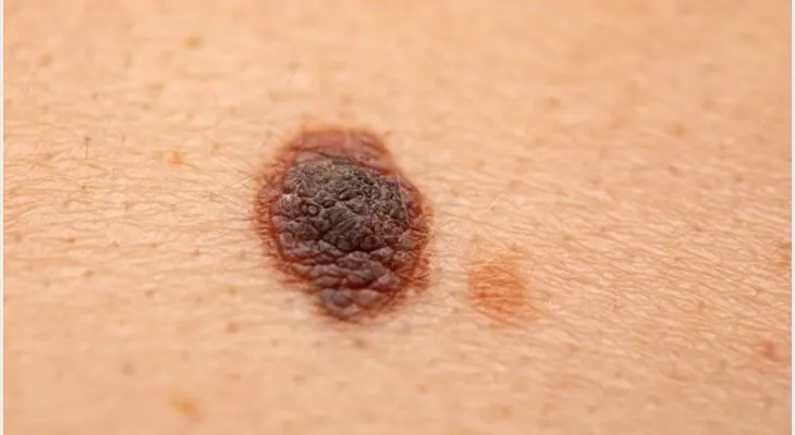 Hallan una nueva vía para las terapias contra el cáncer 