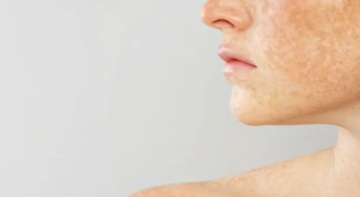 Mascarilla contra el paño? ¡Luce un rostro libre de manchas!