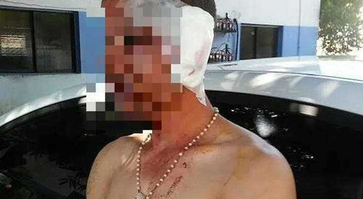 Ganadero le corta las orejas a supuesto ladrón de reces en San José de las Matas