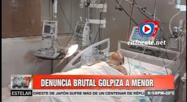 Denuncia que policías golpearon brutalmente a su hijo de 14 años (VIDEO)