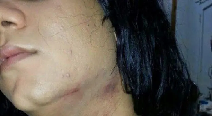 Denuncian policías golpean y dejan inconsciente a una transexual