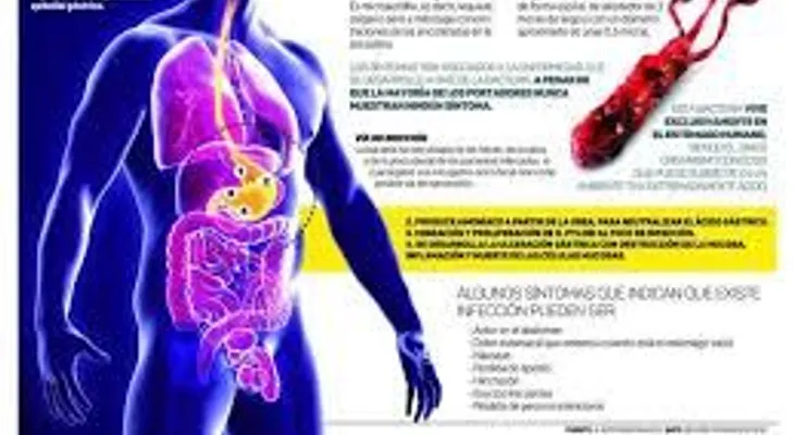 Conoce el mejor tratamiento para liberar tu estómago de bacteria Helicobacter Pylori
