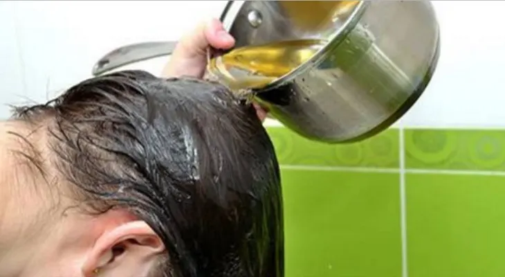 Ella puso esto en su cabeza, su cabello creció sin parar y olvido la calvicie por completo!!!