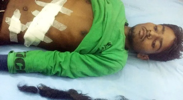 Operan a joven por dolor en el estómago y se impactan por lo que encuentran