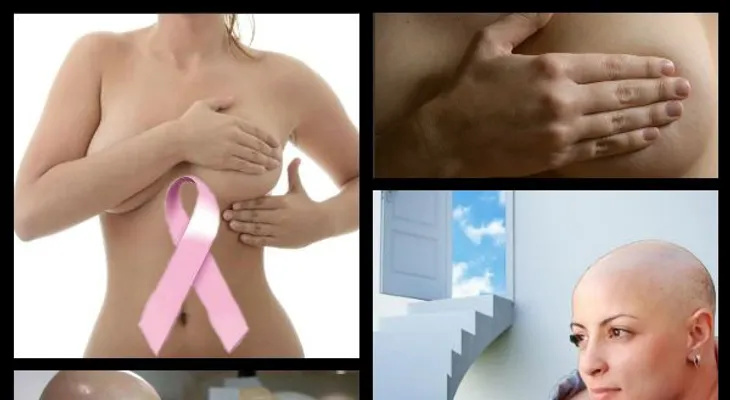 Medicina y quimioterapia aportan beneficios contra el cáncer de mama