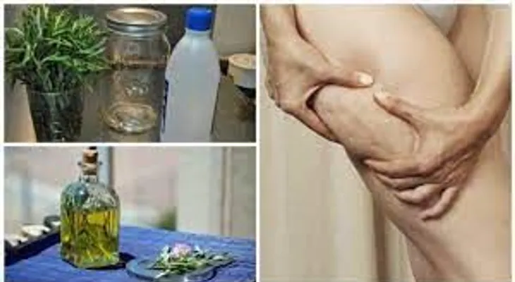 Alcohol de romero para la varices, celulitis, la gota y dolores musculares