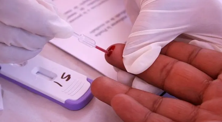 Casos de sida en Chile han aumentado un 96 por ciento desde el 2010 