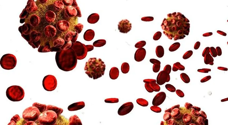 Como prevenir la toxoplasmosis