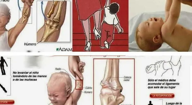 Mira porque es peligroso levantar a los niños por los brazos