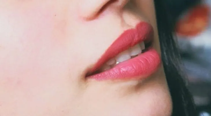 ¿Labios partidos rápido? Aquí te decimos cómo curarlos