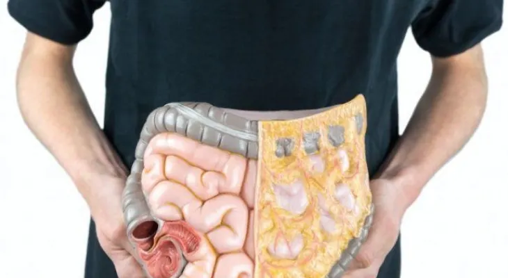 Día Mundial contra el Cáncer de Colon: Cómo prevenirlo