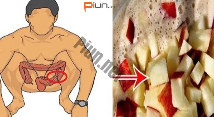Limpia tu colon y pierde 10 kilos en 3 semanas con este remedio. Sorprendente!