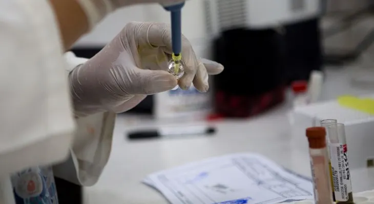 Nuevos lineamientos de la OMS para evitar transmisión sexual del zika