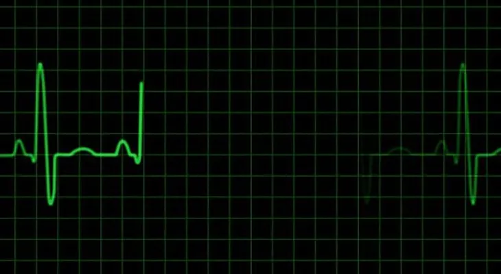 Médicos abren posibilidad para volver de la muerte