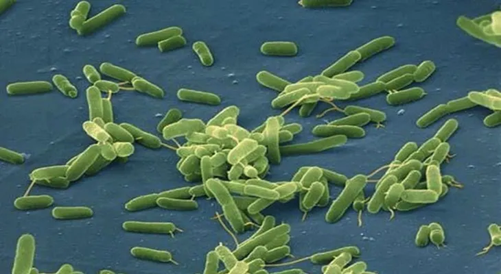 Tres personas mueren en Uruguay por una rara bacteria llamada Vibrio vulnificus