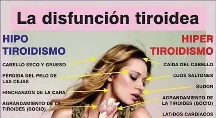 Revelan el secreto mejor guardado en el MUNDO; con esto se cura la tiroides; es un simple remedio