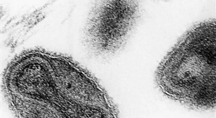 EEUU: Hallan frascos con virus de la viruela
