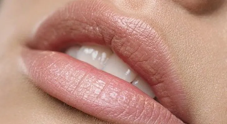 Aclara las manchas oscuras en los labios, con estos remedios caseros