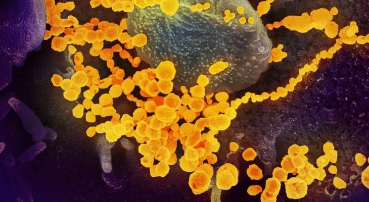 El coronavirus engaña el cuerpo humano como "un lobo con piel de cordero"