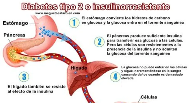 Detectan una posible diana terapéutica para tratar la diabetes tipo 2