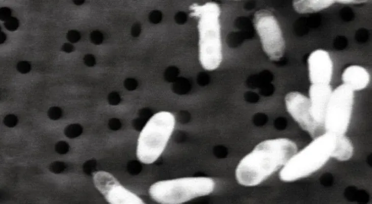 "Es casi demasiado tarde para evitar que haya una superbacteria resistente a los antibióticos