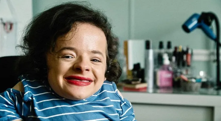 La historia de la joven con "huesos de cristal" que quiere romper con los cánones de belleza