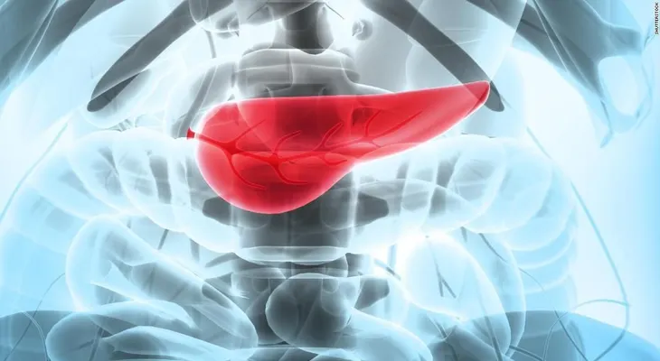â??Páncreas artificialâ?, la esperanza para pacientes con diabetes tipo 2, dice estudio