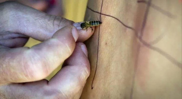 El veneno de las abejas: ¿qué propiedades curativas tiene? 