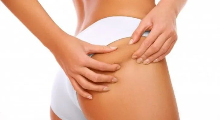 ¿Es posible eliminar la celulitis definitivamente?