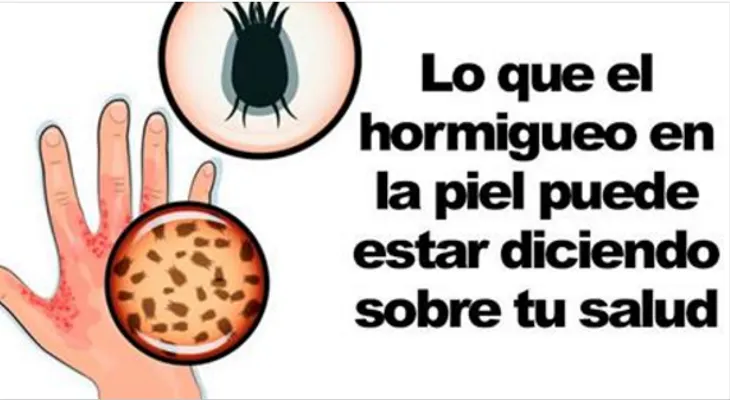 Si el hormigueo persiste debes ir rápido donde un médico: Que lo provoca y cómo curarlo?