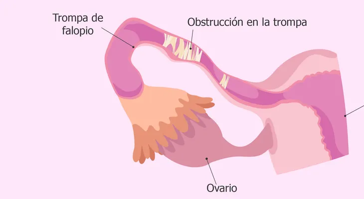  Un estudio ofrece pruebas que el colesterol puede afectar la esterilidad femenina 