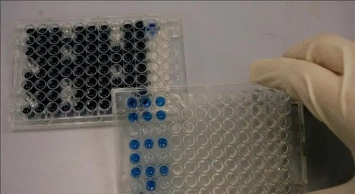 Médico cubano curado del ébola se recupera para volver a Sierra Leona