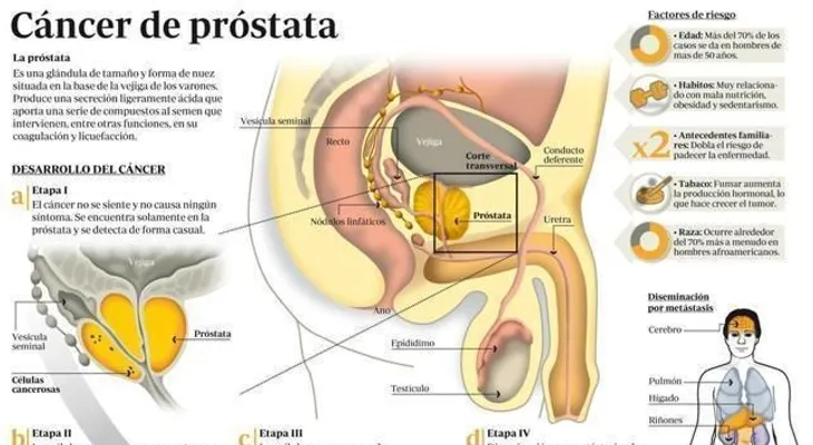 Tratamiento del cáncer de próstata que no desaparece o que regresa después del tratamiento