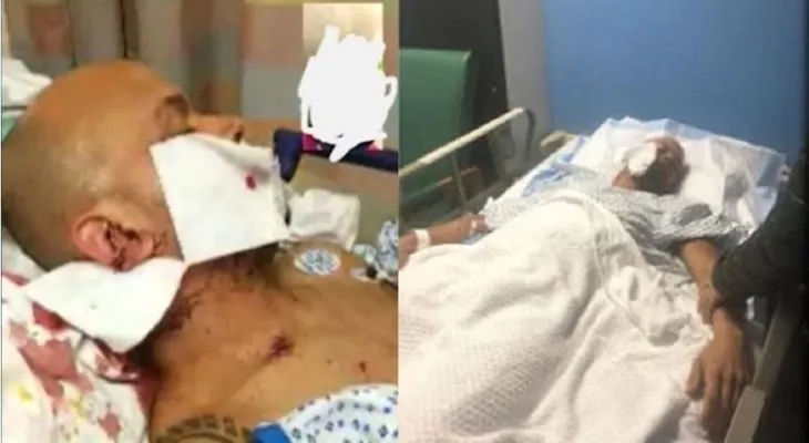Grave un taxista dominicano Alex Acosta, apuñalado en el cuello durante atraco en el Bronx