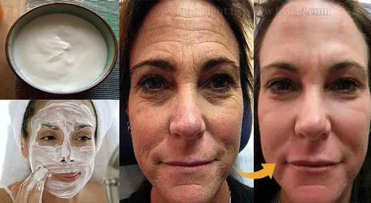 Cientos de mujeres estas usando esta crema casera para rejuvenecer la piel de su cara