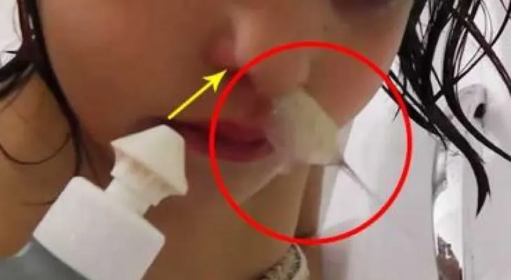 Esta niña sufría de sinusitis y mira lo que sacaron de su nariz! SORPRENDENTE!