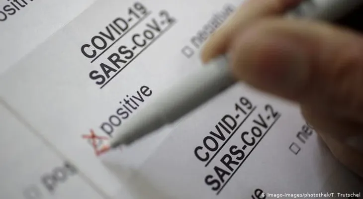 RD y otros países de Latinoamerica recibirán más de 1.3 millones de kits para detectar coronavirus 