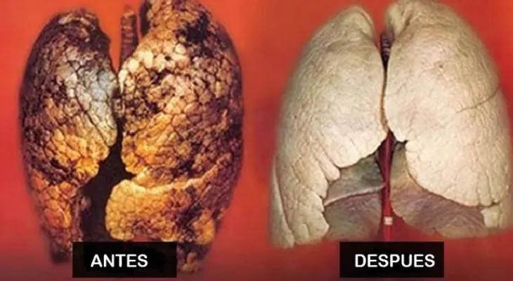Cómo purificar tus pulmones en menos de 2 días 