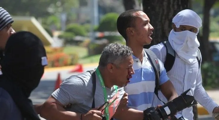 PN asegura trabaja para identificar agente que disparó a reportero de elCaribe