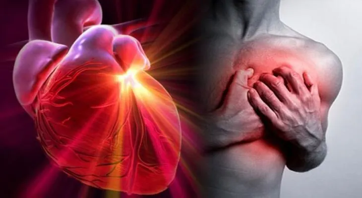 Enfermedades cardiovasculares son la 1ra causa de muerte en Venezuela