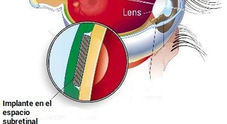 Cómo funciona la visión artificial, ¡Nadie te lo explicará mejor!